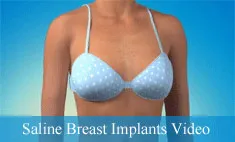 Saline Breast Implants Video