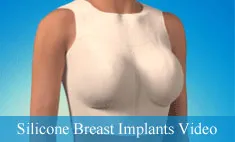 Silicone Breast Implants Video